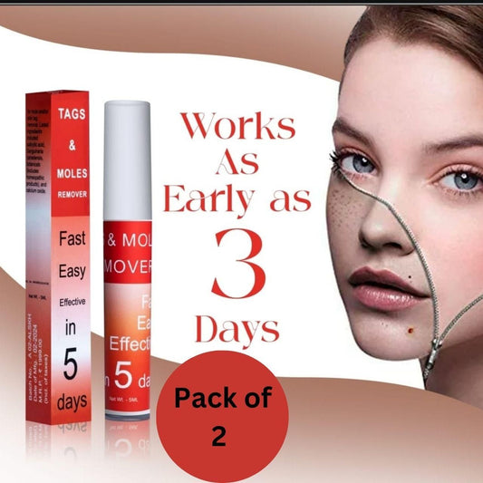 Tags & Moles Remover (BUY 1 GET 1 FREE) (98999+++Happy Customer ⭐⭐⭐⭐⭐)