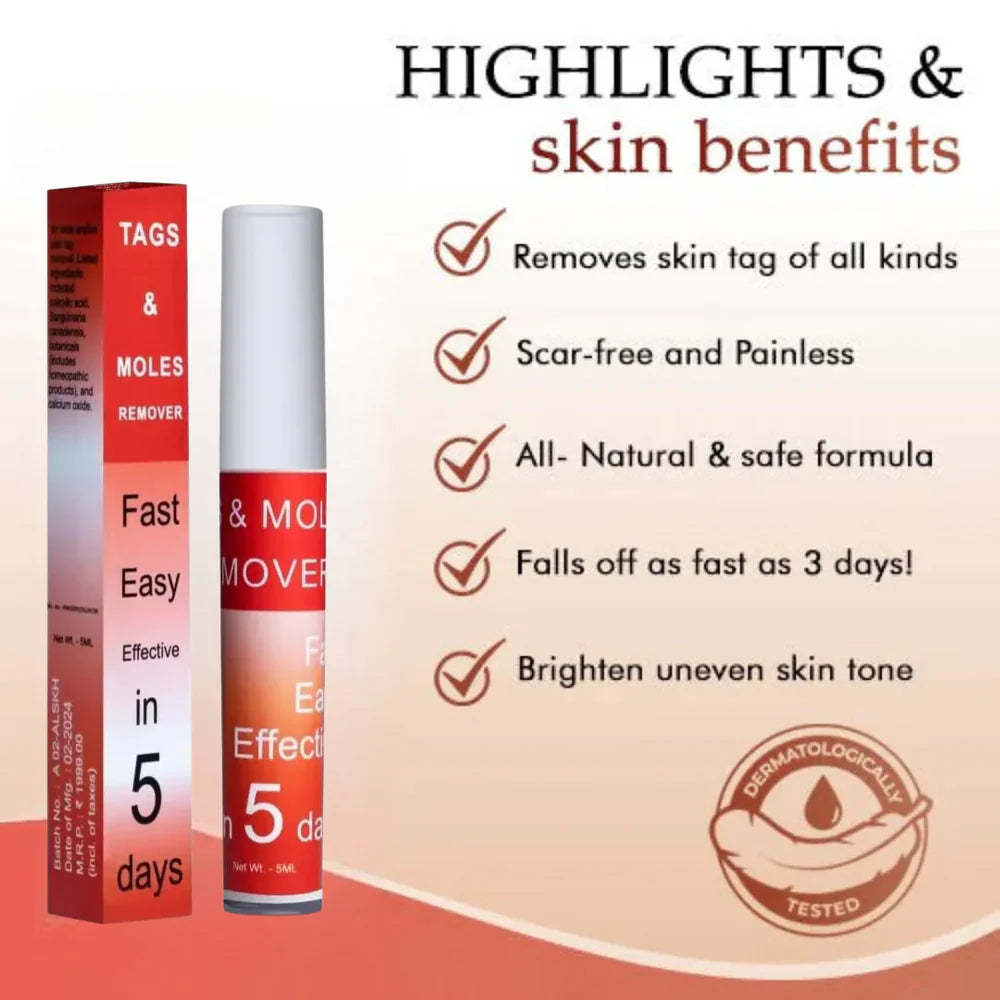 Tags & Moles Remover (BUY 1 GET 1 FREE) (98999+++Happy Customer ⭐⭐⭐⭐⭐)