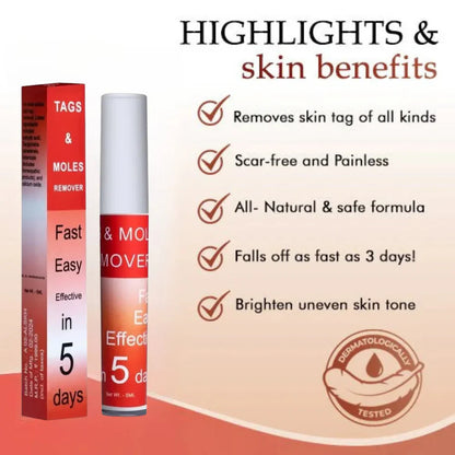 Tags & Moles Remover (BUY 1 GET 1 FREE) (98999+++Happy Customer ⭐⭐⭐⭐⭐)